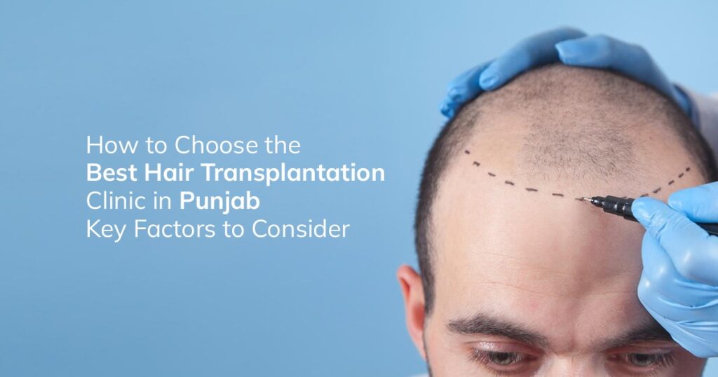Best hair transplantation Clinic in Punjab