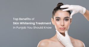 Skin Whitening Treatment in Punjab