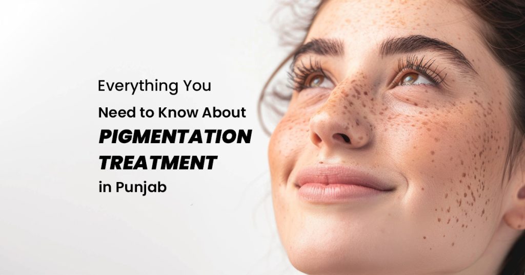Pigmentation Treatment in Punjab