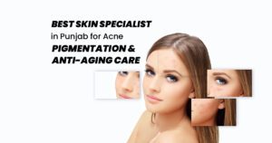 Best Skin Specialist in Punjab for Acne, Pigmentation & Anti-Aging Care
